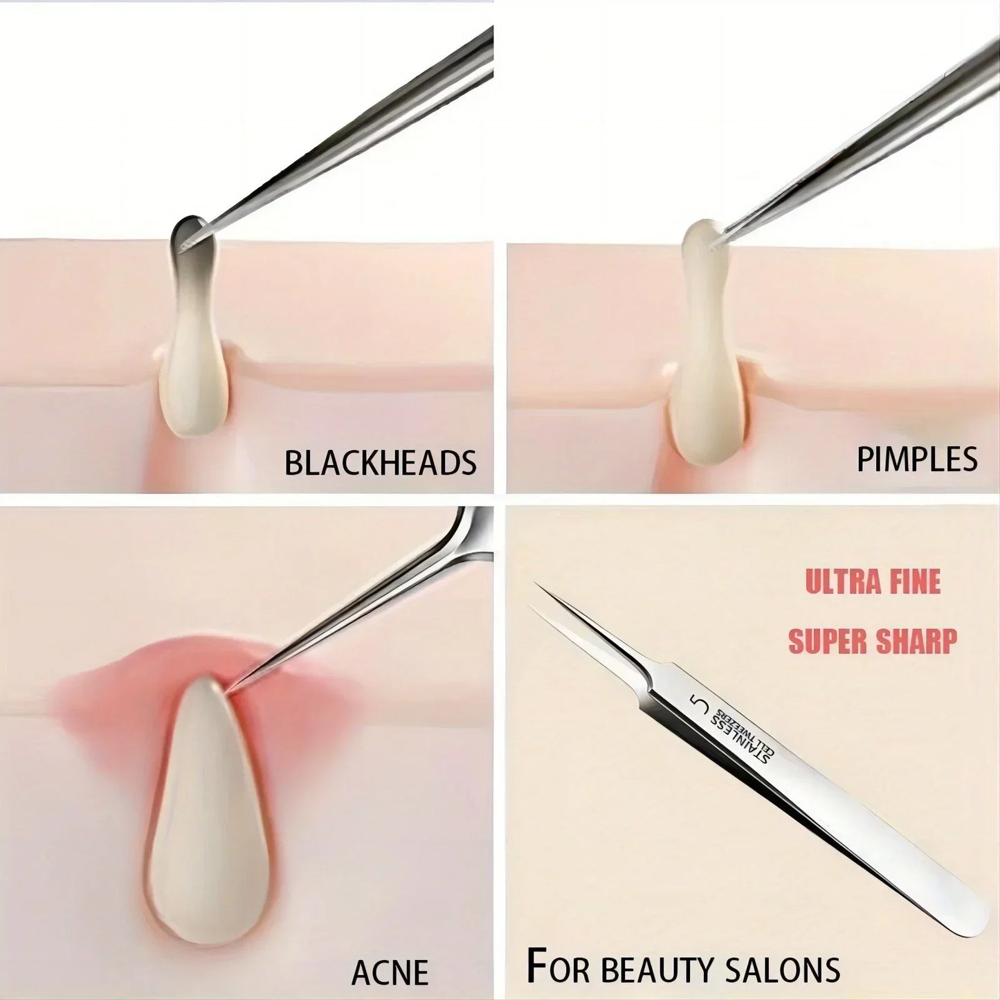 Blackhead Tweezers